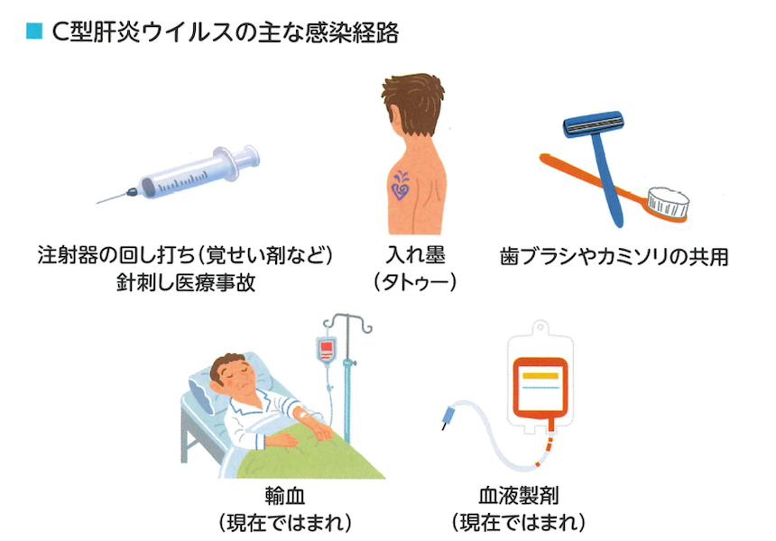 C型肝炎の主な感染経路